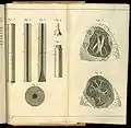 De l'auscultation médiate&nbsp;.... Drawings of the stethoscope and lungs.